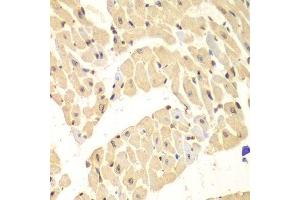 Immunohistochemistry of paraffin-embedded mouse heart using HIF1AN antibody. (HIF1AN anticorps  (AA 1-349))