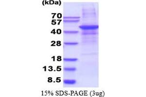 SDS-PAGE (SDS) image for Matrix Metallopeptidase 28 (MMP28) (AA 123-520) protein (His tag) (ABIN5853528)