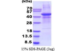 SDS-PAGE (SDS) image for Matrix Metallopeptidase 28 (MMP28) (AA 123-520) protein (His tag) (ABIN5853528) (MMP28 Protein (AA 123-520) (His tag))