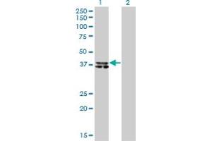 Western Blot analysis of B4GALT4 expression in transfected 293T cell line by B4GALT4 monoclonal antibody (M01), clone 5E2. (B4GALT4 anticorps  (AA 35-134))