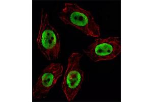 Immunofluorescent staining of U251 cell reacted with EZH2 monoclonal antibody  at 1:10-1:50 dilution. (EZH2 anticorps)