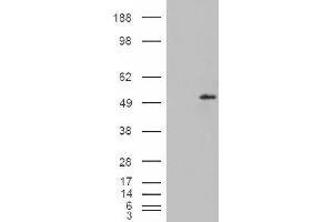 Image no. 2 for anti-STEAP Family Member 4 (STEAP4) (C-Term) antibody (ABIN375107) (STEAP4 anticorps  (C-Term))