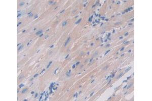 IHC-P analysis of Human Tissue, with DAB staining. (TNNC1 anticorps  (AA 1-161))