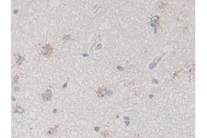 Detection of TGFb3 in Human Cerebrum Tissue using Monoclonal Antibody to Transforming Growth Factor Beta 3 (TGFb3)