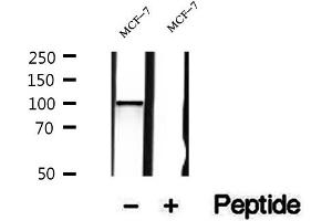 Western blot analysis of extracts of MCF-7 cells, using LIV-1/ZIP6 antibody.
