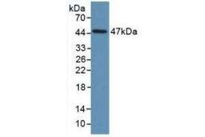 Detection of Recombinant PAI1, Human using Monoclonal Antibody to Plasminogen Activator Inhibitor 1 (PAI1)