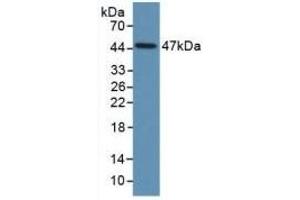 Detection of Recombinant PAI1, Human using Monoclonal Antibody to Plasminogen Activator Inhibitor 1 (PAI1) (PAI1 anticorps)