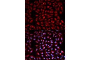 Immunofluorescence analysis of U2OS cell using RARA antibody. (Retinoic Acid Receptor alpha anticorps)