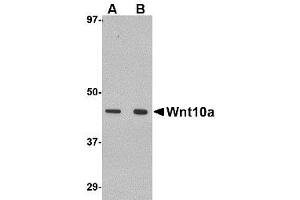 Image no. 1 for anti-Wingless-Type MMTV Integration Site Family, Member 10A (WNT10A) (C-Term) antibody (ABIN1492215) (WNT10A anticorps  (C-Term))