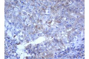 Image no. 4 for anti-Selenium Binding Protein 1 (SELENBP1) antibody (ABIN1500860)