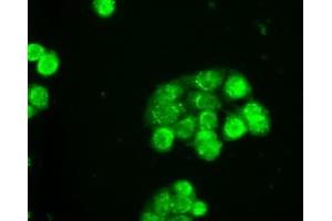 Immunofluorescent staining of HT29 cells using anti-SLC2A5 mouse monoclonal antibody (ABIN2452384).