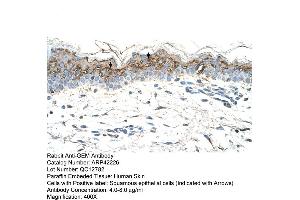 Rabbit Anti-GEM Antibody  Paraffin Embedded Tissue: Human Skin Cellular Data: Squamous epithelial cells Antibody Concentration: 4.