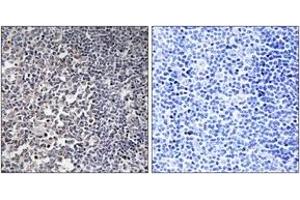 Immunohistochemistry (IHC) image for anti-Mitochondrial Ribosomal Protein S16 (MRPS16) (AA 81-130) antibody (ABIN2890039) (MRPS16 anticorps  (AA 81-130))