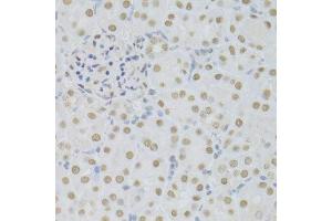 Immunohistochemistry of paraffin-embedded mouse kidney using SFN Antibody. (14-3-3 sigma/SFN anticorps  (AA 1-248))