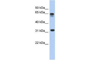 WB Suggested Anti-RPS3A Antibody Titration: 0. (RPS3A anticorps  (N-Term))