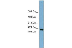 WB Suggested Anti-ANKRD37 Antibody Titration: 0. (ANKRD37 anticorps  (Middle Region))