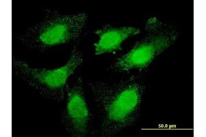 Immunofluorescence of monoclonal antibody to TOP3B on HeLa cell. (TOP3B anticorps  (AA 1-862))