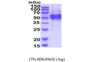 SDS-PAGE (SDS) image for Diphthamide Biosynthesis Protein 2 (DPH2) (AA 1-489) protein (His tag) (ABIN6388024)