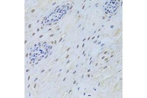 Immunohistochemistry of paraffin-embedded human esophagus using TARDBP Antibody.