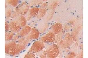 DAB staining on IHC-P; Samples: Mouse Skeletal muscle Tissue (PDGFC anticorps  (AA 23-345))