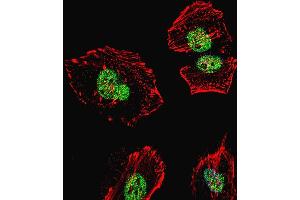 Fluorescent confocal image of Hela cell stained with NCL Antibody (Center ) (ABIN655626 and ABIN2845105).