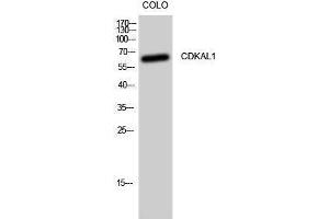 Western Blotting (WB) image for anti-CDK5 Regulatory Subunit Associated Protein 1-Like 1 (CDKAL1) (N-Term) antibody (ABIN3174325) (CDKAL1 anticorps  (N-Term))