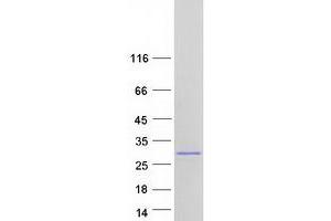 Validation with Western Blot