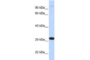 WB Suggested Anti-ZNF688 Antibody Titration:  0. (ZNF688 anticorps  (Middle Region))