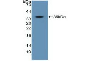 Western blot analysis of recombinant Human IGF2R. (IGF2R anticorps  (AA 2167-2442))