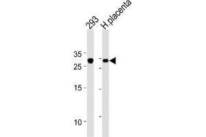 Western Blotting (WB) image for anti-Transcription Factor 21 (TCF21) antibody (ABIN2996267) (TCF21 anticorps)