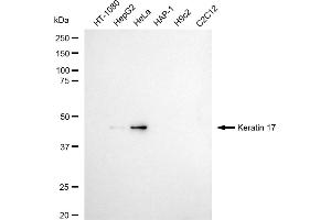 Western blotting analysis using Keratin 17 antibody (ABIN7799172).