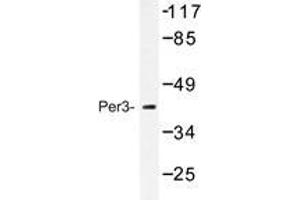 Western blot analysis of Per3 antibody in extracts from Jurkat cells treated with insulin 0. (PER3 anticorps)