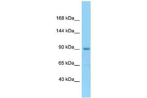 WB Suggested Anti-ESCO1 Antibody Titration: 1.