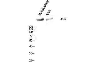 Western Blotting (WB) image for anti-Ataxia Telangiectasia Mutated (ATM) (Ser159) antibody (ABIN3173946) (ATM anticorps  (Ser159))