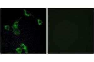 Immunofluorescence analysis of COS7 cells, using CIDEB Antibody. (CIDEB anticorps  (AA 91-140))