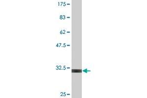 Western Blot detection against Immunogen (29. (UCP1 anticorps  (AA 232-267))