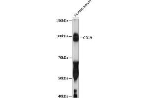 Western blot analysis of extracts of Human serum, using CD19 antibody (ABIN7266169) at 1:1000 dilution.