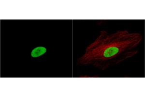 anti-X-Ray Repair Cross Complementing 5 antibody