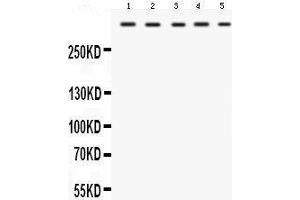 Western blot analysis of TRIO expression in rat cardiac muscle extract (lane 1), rat skeletal muscle extract (lane 2), mouse cardiac muscle extract (lane 3), mouse skeletal muscle extract (lane 4) and HELA whole cell lysates (lane 5). (TRIO anticorps  (C-Term))