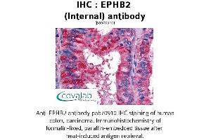 Image no. 1 for anti-EPH Receptor B2 (EPHB2) (Internal Region) antibody (ABIN1734081) (EPH Receptor B2 anticorps  (Internal Region))