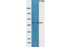 Lane 1: Mouse intestinal lysates Lane 2: mouse testicular lysates  probed with Rabbit Anti-Cdc25C Polyclonal Antibody, Unconjugated (ABIN1387108) at 1:300 overnight at 4 °C.