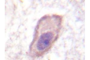 Immunohistochemistry analyzes of IFNGRA antibody in paraffin-embedded human brain tissue. (IFNGR1 anticorps)