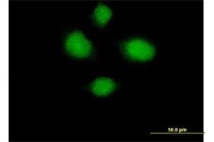 Immunofluorescence of purified MaxPab antibody to HSH2D on HeLa cell.