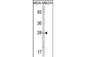 Western blot analysis of COLEC11 Antibody in MDA-MB231 cell line lysates (35ug/lane) (COLEC11 anticorps  (N-Term))