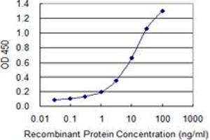 Detection limit for recombinant GST tagged XPR1 is 0.