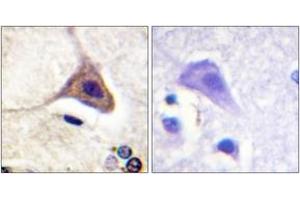 Immunohistochemistry analysis of paraffin-embedded human brain, using Opioid Receptor-delta (Phospho-Ser363) Antibody. (OPRD1 anticorps  (pSer363))