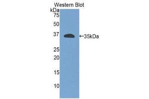Western Blotting (WB) image for anti-Integrin beta 4 (ITGB4) (AA 923-1197) antibody (ABIN1859507)