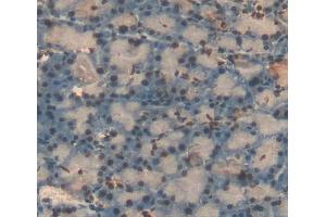 Used in DAB staining on fromalin fixed paraffin- embedded pancreas tissue (NR5A2 + LRH1 anticorps  (AA 1-205))