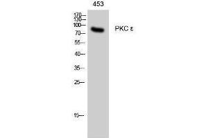 Western Blotting (WB) image for anti-Protein Kinase C, epsilon (PRKCE) (Thr308) antibody (ABIN3186475)