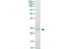 ATG5 monoclonal antibody (M06), clone 3G11. (ATG5 anticorps  (AA 176-275))